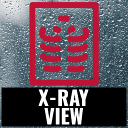X-ray view