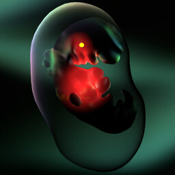 �xito en el nivel 9