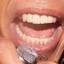 Steven Tyler&#039;s Front Teeth